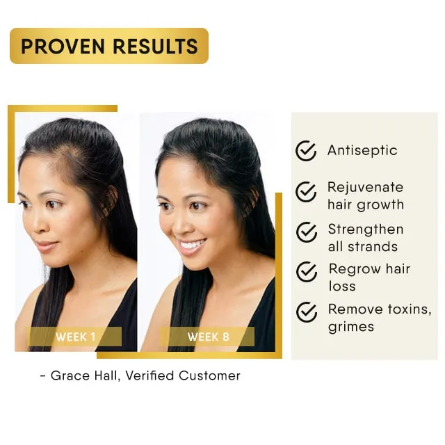 NARUTIN™ Hair Fast Regrowth Essential Serum