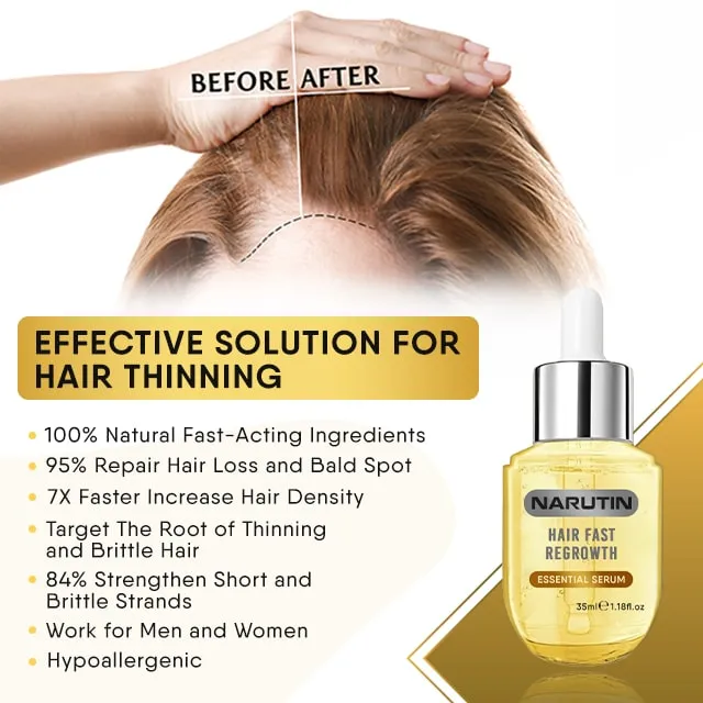 NARUTIN™ Hair Fast Regrowth Essential Serum
